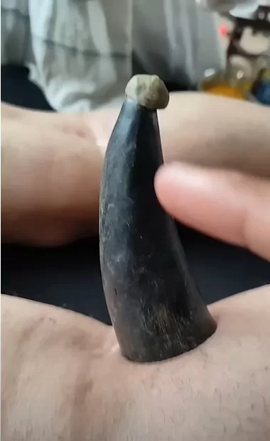 हॉर्न थेरेपी 