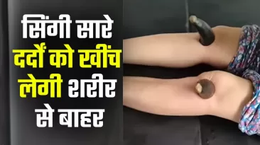 सिंगी चिकित्सा