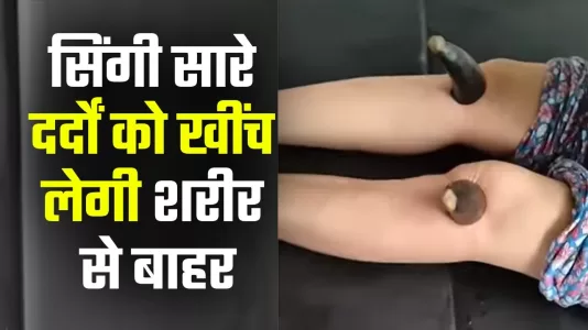 सिंगी चिकित्सा