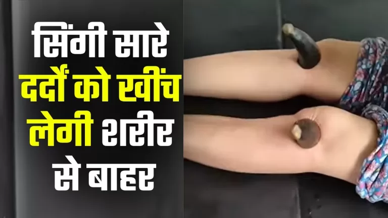 सिंगी चिकित्सा