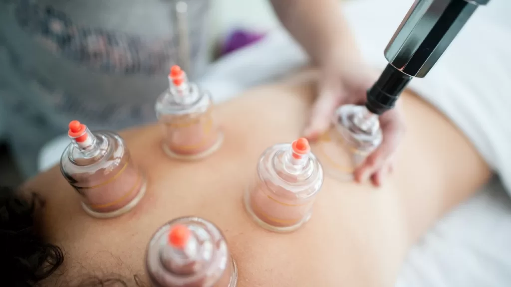 cupping therapy benefits