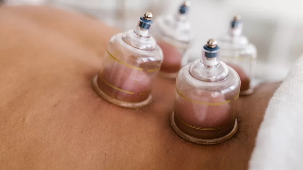 benefits of cupping therapy 