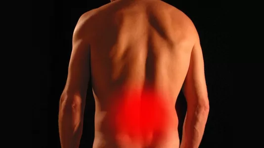 sciatica